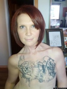 o-KELLY-DAVIDSON-MASTECTOMY-PHOTO-570
